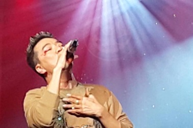 Diễn quá sung, Đàm Vĩnh Hưng gặp tai nạn chảy máu mắt