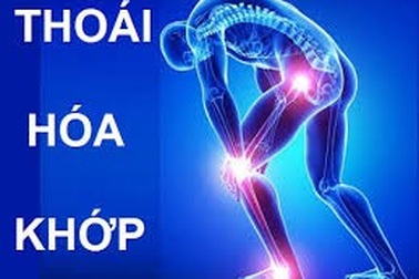 Thực hư liệu pháp tế bào gốc trong thoái khớp