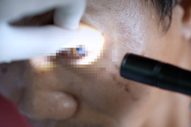 Vụ tạt axit khiến 8 người thương vong: Có nạn nhân bỏng nặng 2 mắt, tứ chi