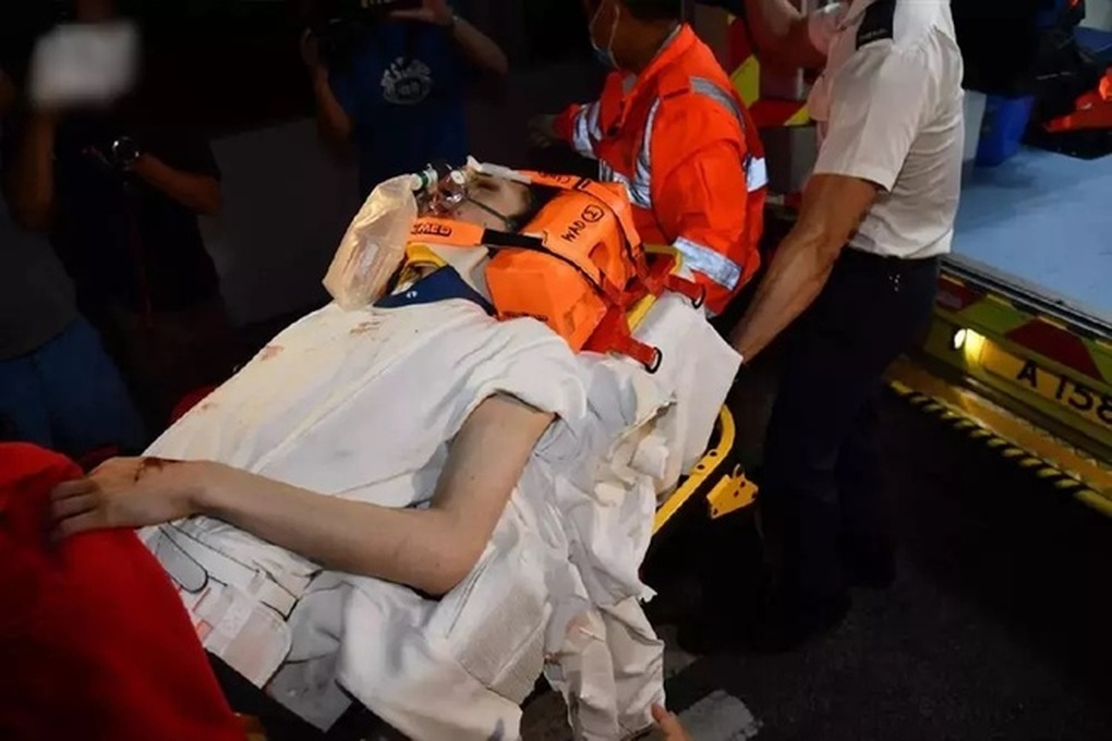 Tình hình hiện tại của nam vũ công bị màn hình nặng 600kg rơi trúng người - 1