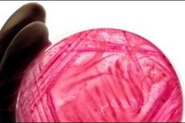 Ca đầu tiên tử vong và thực hư quanh siêu vi khuẩn kháng thuốc