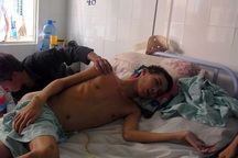 Xót xa cậu sinh viên đi làm thêm bị té từ lầu 2