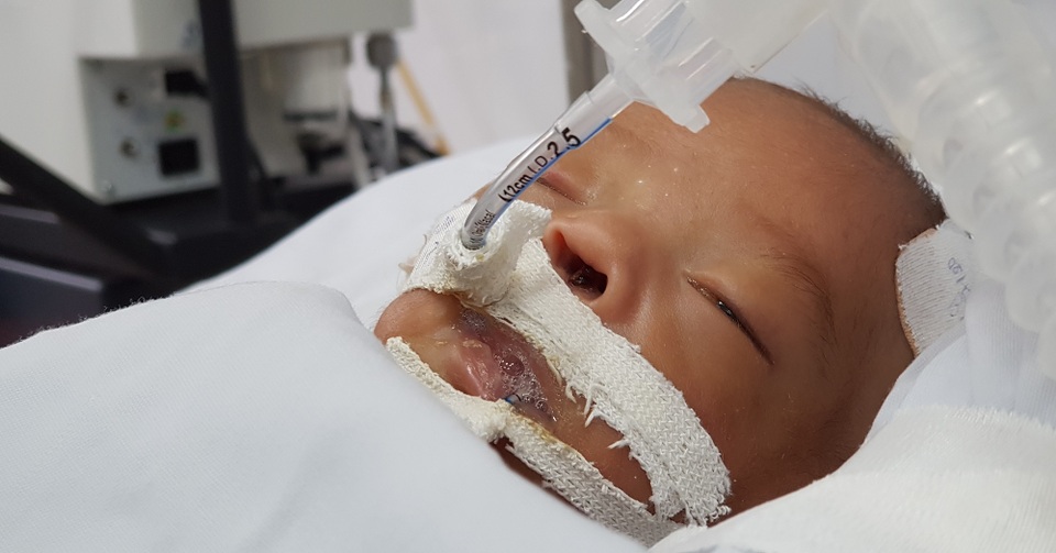 Sự sống mong manh của bé trai bị bỏ rơi hấp hối trong sân chùa - 5 Sự sống mong manh của bé trai bị bỏ rơi hấp hối trong sân chùa - 5