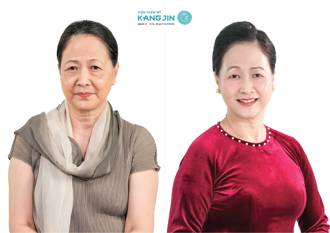 Dàn sao Việt bắt Trend trẻ hóa thống lĩnh xứ Kim Chi - 2 Dàn sao Việt bắt Trend trẻ hóa thống lĩnh xứ Kim Chi - 2