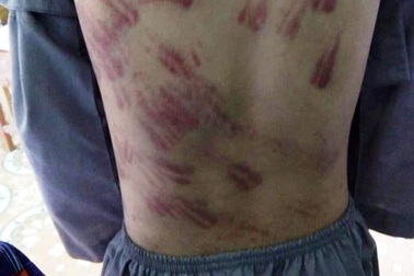 Cháu bé mồ côi bị sư thầy hành hạ: Đề nghị công an vào cuộc