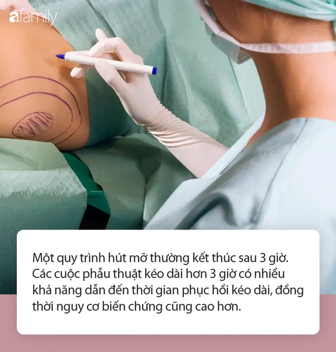 Hút mỡ không hề đơn giản từ chuẩn bị đến khi phẫu thuật và phục hồi: Chuyên gia đưa bảng lưu ý trước khi làm ai cũng nên nhớ! - Ảnh 1. Hút mỡ không hề đơn giản từ chuẩn bị đến khi phẫu thuật và phục hồi: Chuyên gia đưa bảng lưu ý trước khi làm ai cũng nên nhớ! - Ảnh 1.