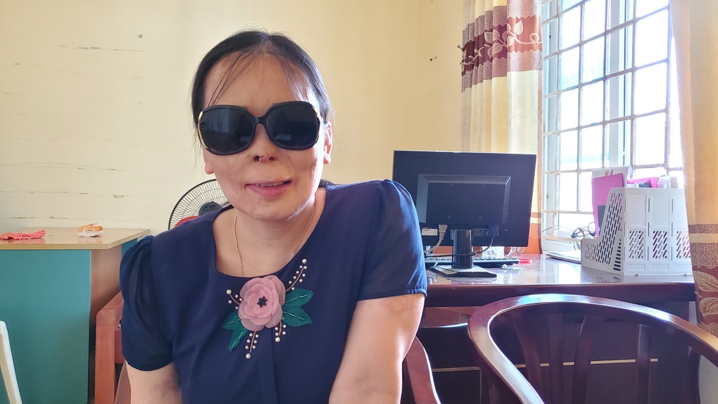 Cuộc sống của cô giáo sau 22 năm bị người yêu cũ tạt a xít vào mặt - 2 Cuộc sống của cô giáo sau 22 năm bị người yêu cũ tạt a xít vào mặt - 2