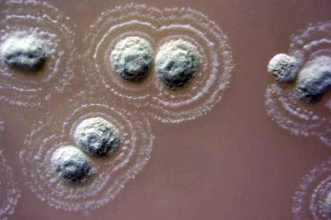 Phát hiện loại vi khuẩn đặc biệt… quanh khu định cư của người Ireland cổ đại