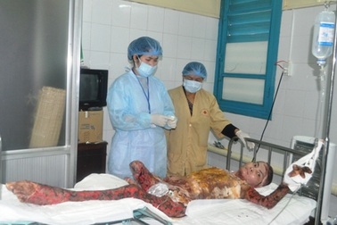 Cứu sống bệnh nhân bỏng nặng 70%