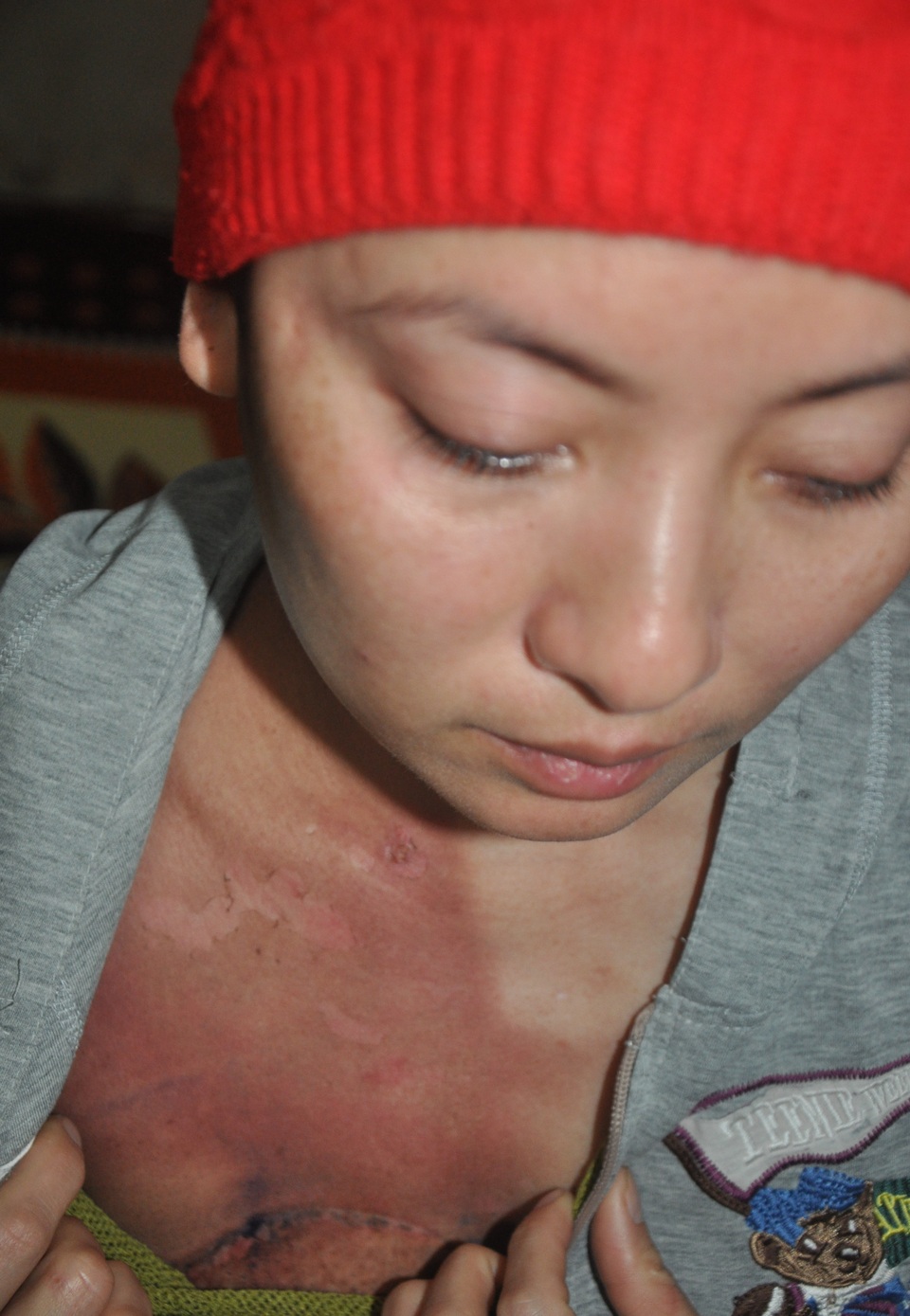Người mẹ nghèo cận kề cái chết chỉ mong con đừng bỏ học - 2 Người mẹ nghèo cận kề cái chết chỉ mong con đừng bỏ học - 2