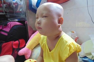 Sự sống mong manh của bé gái 5 tuổi mắc chứng ung thư hạch