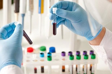 Tầm soát bệnh ung thư tiêu hóa và gan mật