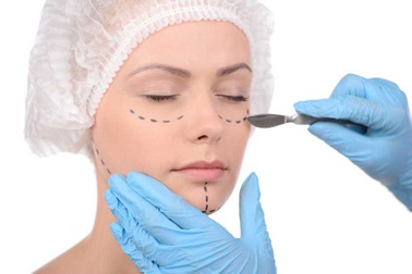 5 sự thật ít ai biết nếu bạn có ý định thẩm mỹ mắt