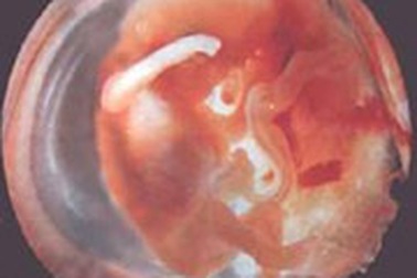 Những giai đoạn phát triển quan trọng của não bộ thai nhi