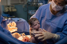 Bé sơ sinh từng nổi tiếng khắp thế giới qua một bức ảnh, bây giờ thế nào?