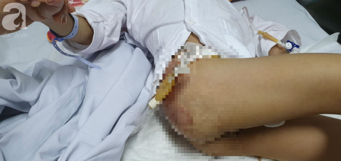 Mẹ khóc cạn nước mắt vì đứa con trai bại não bị 4 con chó cắn đứt bộ phận sinh dục - Ảnh 5. Mẹ khóc cạn nước mắt vì đứa con trai bại não bị 4 con chó cắn đứt bộ phận sinh dục - Ảnh 5.