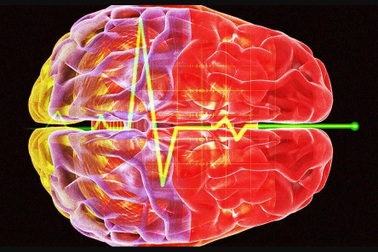 Lần đầu tiên ghi được sóng não của người chết, hé lộ sự thật khủng khiếp