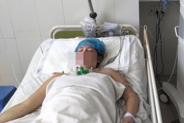 Ngộ độc methanol: Mù mắt, hoại tử não vĩnh viễn, tỉ lệ tử vong lên đến 50%