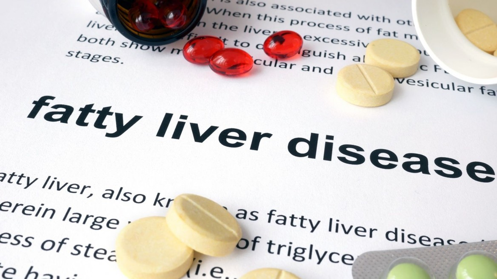Gan nhiễm mỡ nên tránh xa những loại thực phẩm nào? - 2 Gan nhiễm mỡ nên tránh xa những loại thực phẩm nào? - 2