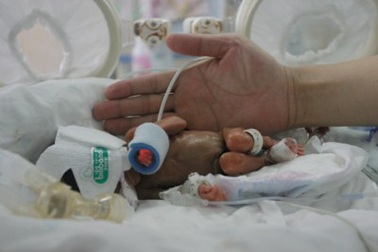 Em bé sơ sinh chỉ nặng... 4 lạng 