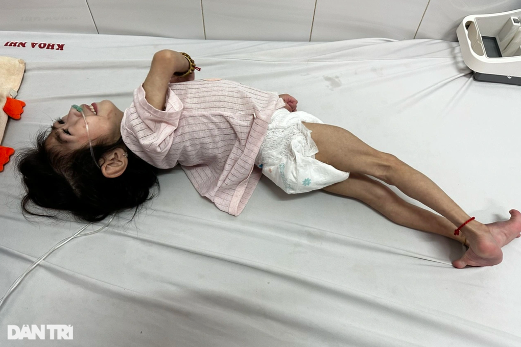 Con gái 3 tuổi bại não, gầy trơ xương và người mẹ nhiều lần thất hứa - 3 Con gái 3 tuổi bại não, gầy trơ xương và người mẹ nhiều lần thất hứa - 3