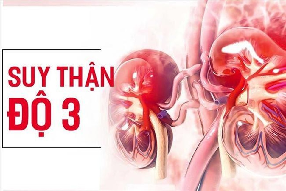 Tại sao người bị suy thận độ 3 nên dùng Ích Thận Vương? - 1 Tại sao người bị suy thận độ 3 nên dùng Ích Thận Vương? - 1