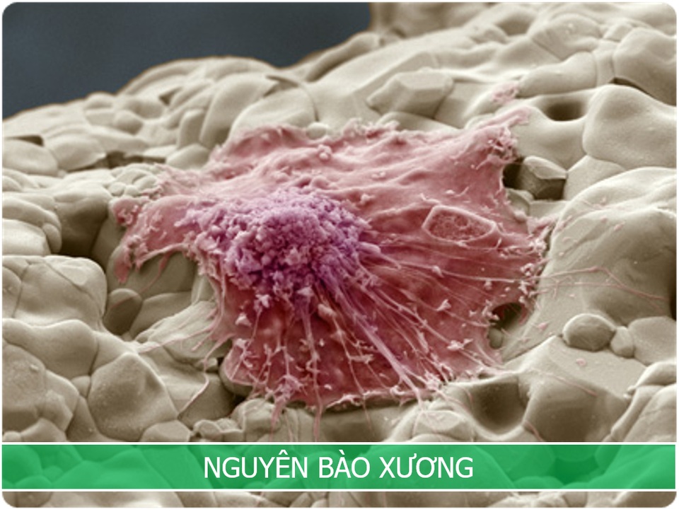 Phát hiện thứ có thể “ru ngủ” ung thư hàng chục năm ngay trong xương chúng ta - 2 Phát hiện thứ có thể “ru ngủ” ung thư hàng chục năm ngay trong xương chúng ta - 2