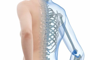 Ô nhiễm không khí có thể gây loãng xương