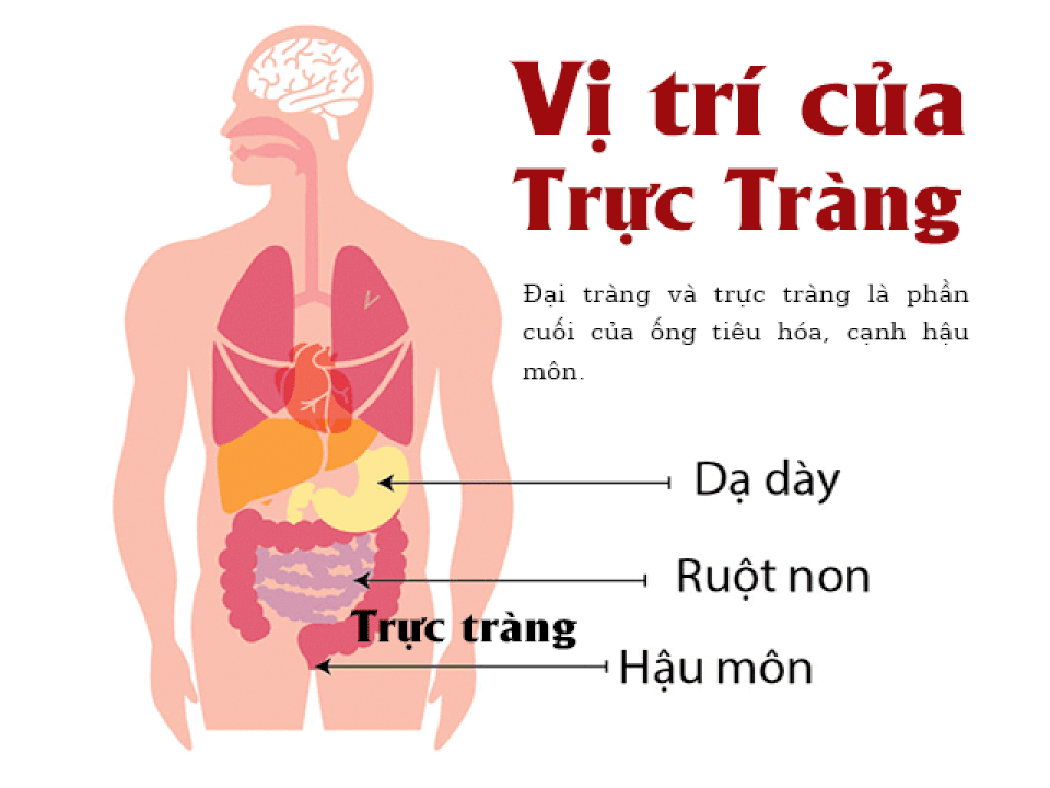 7 dấu hiệu cảnh báo sớm ung thư đại trực tràng - 1 7 dấu hiệu cảnh báo sớm ung thư đại trực tràng - 1
