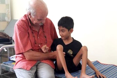 Khám sàng lọc dị tật cơ xương khớp cho trẻ em ở Phú Yên