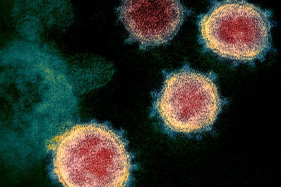 Vì sao truy tìm nguồn gốc virus SARS-CoV-2 giống như “mò kim đáy bể“? - 1 Vì sao truy tìm nguồn gốc virus SARS-CoV-2 giống như “mò kim đáy bể“? - 1