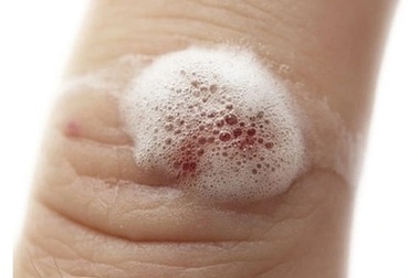 3 sai lầm khi sử dụng oxy già sát khuẩn gây hại khôn lường