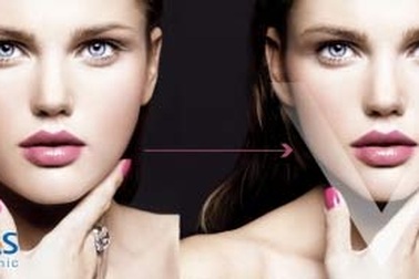 V-Line F2 – Đỉnh cao của sự hoàn mỹ