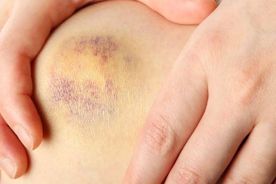 13 dấu hiệu ung thư ở nam giới không nên bỏ qua - 5 13 dấu hiệu ung thư ở nam giới không nên bỏ qua - 5