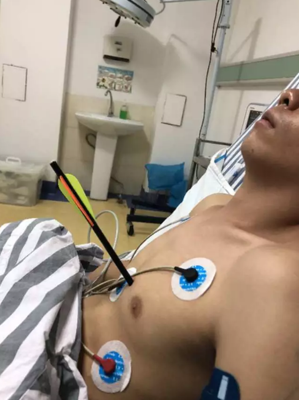 Tỉnh táo bước vào viện chờ cấp cứu với dao phay cắm trên đầu - 3 Tỉnh táo bước vào viện chờ cấp cứu với dao phay cắm trên đầu - 3
