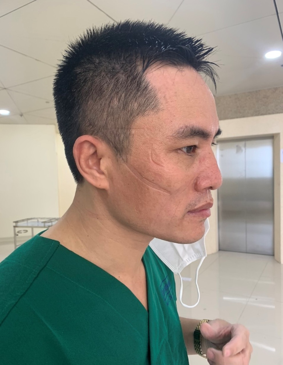 Xúc động bài thơ làm vội sau ca chăm sóc BN Covid-19 của nam điều dưỡng - 4 Xúc động bài thơ làm vội sau ca chăm sóc BN Covid-19 của nam điều dưỡng - 4