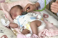 Kỳ lạ bé gái mới sinh đã đảo ngược hoàn toàn phủ tạng, tim nằm bên phải