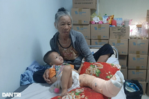 Bi đát hoàn cảnh 2 mẹ con từ viện về bị xe tải cán nát chân