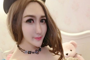 Nổi tiếng vì phẫu thuật thẩm mỹ “hỏng”