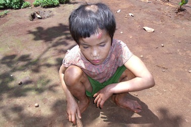 Gần 5 triệu trẻ em VN sống trong hoàn cảnh đặc biệt