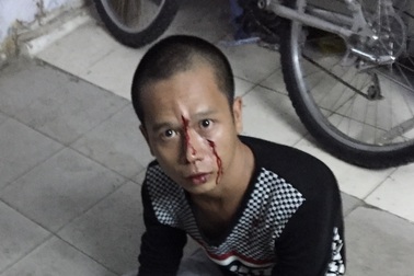 Tên cướp bị bắt vì chạy vào điểm kẹt xe