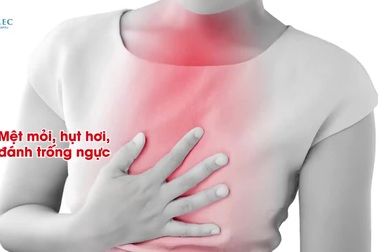 Những đối tượng F0 khỏi bệnh nên đi khám hậu Covid-19