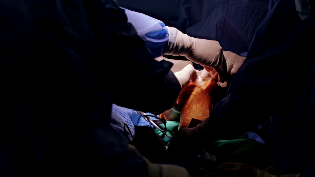 Bên trong phòng mổ thay khớp nhân tạo in 3D cho bé trai 10 tuổi mắc ung thư xương - 8 Bên trong phòng mổ thay khớp nhân tạo in 3D cho bé trai 10 tuổi mắc ung thư xương - 8