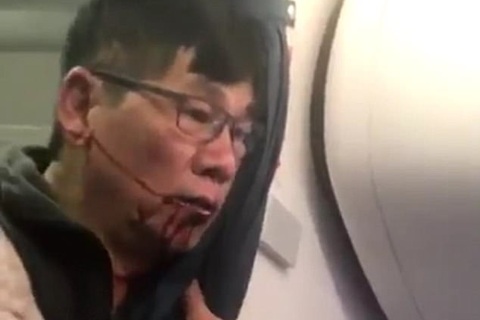 Báo Mỹ hứng chỉ trích vì moi móc đời tư của hành khách bị kéo lê trên máy bay