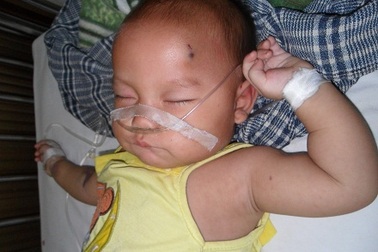 Bị nhiễm trùng huyết, bé gái 8 tháng tuổi lay lắt như “đèn trước gió”