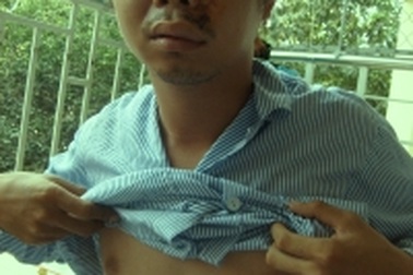 6 khách du lịch bị quây đánh dã man