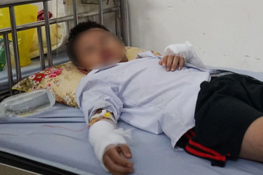 Bóng bay phát nổ khiến 10 học sinh bị bỏng: Do thầy giáo hút thuốc lá