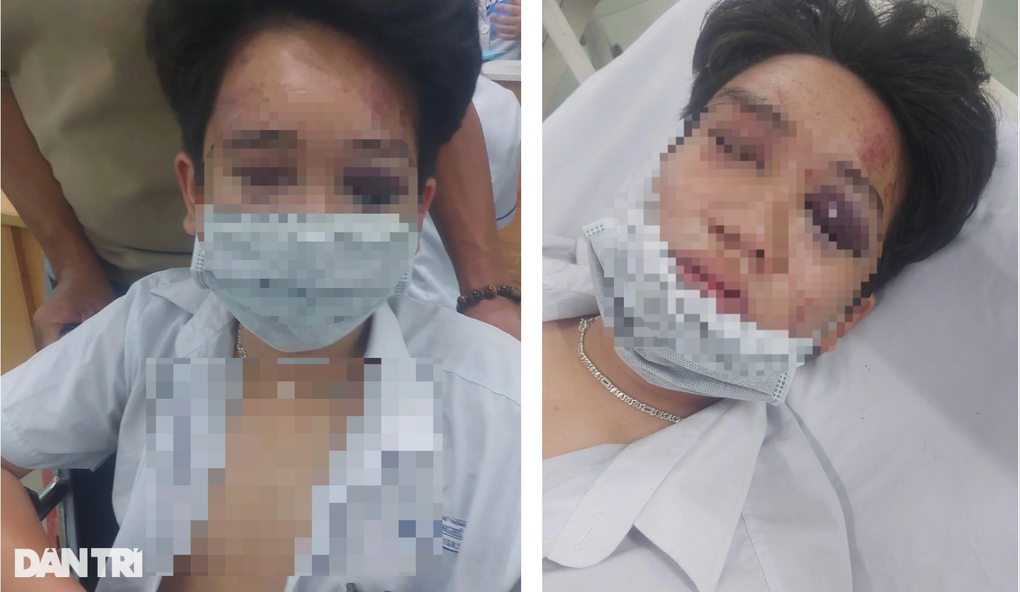 Vụ nam sinh bị bạn đánh vỡ xương trán: Bạn bắt em chui qua háng - 1 Vụ nam sinh bị bạn đánh vỡ xương trán: Bạn bắt em chui qua háng - 1