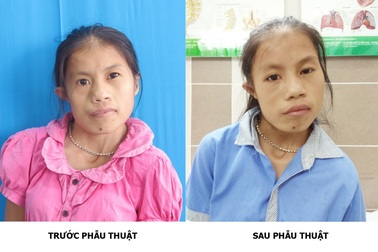 Phép màu xuất hiện sau 20 năm cuộc đời của cô gái trẻ Thái Nguyên