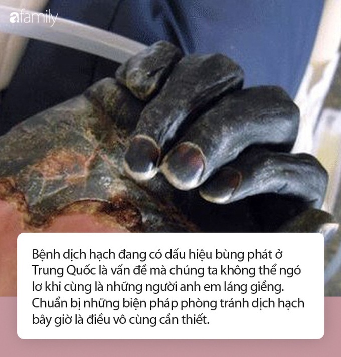 Trường hợp thứ tư mắc bệnh dịch hạch tại Trung Quốc: Bệnh dịch hạch đáng sợ thế nào? - Ảnh 3.